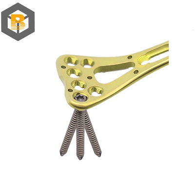 Parcela de usinagem de precisão CNC para benefício da placa de bloqueio de pluma de raio distal multi-axial